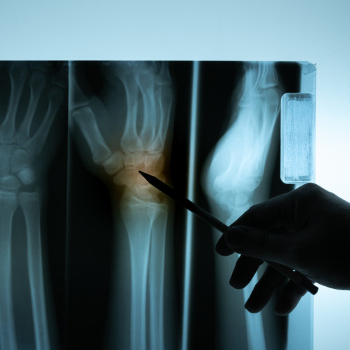 hand pointing on an x-ray result